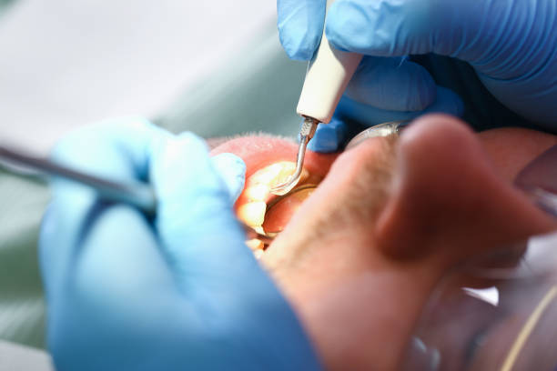 Best Emergency Treatment for Toothache in Essex Village, CT