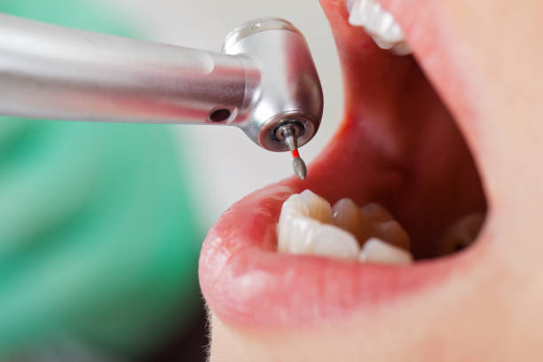 Best Emergency Treatment for Toothache in Essex Village, CT